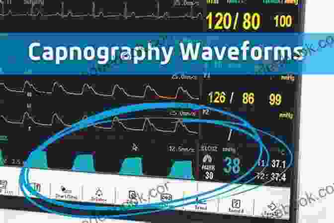 Capnography Image Displaying The Capnography Waveform On A Monitor An Update On Airway Management (Recent Advances In Anesthesiology 3)