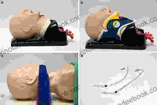 Videolaryngoscopy Image Showing Improved Visualization Of The Airway An Update On Airway Management (Recent Advances In Anesthesiology 3)