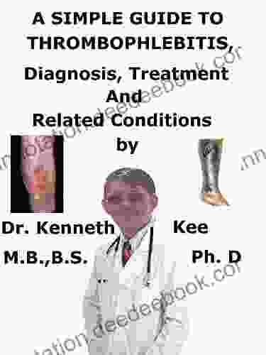 A Simple Guide To Thrombophlebitis Diagnosis Treatment And Related Conditions