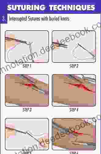 Atlas Of Suturing Techniques: Approaches To Surgical Wound Laceration And Cosmetic Repair